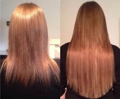 F&ouml;re och efter bilder h&aring;rf&ouml;rl&auml;ngningar Avezu L&ouml;sh&aring;r